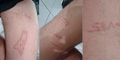 Confirmaron ocho casos de adolescentes internados por juego de la Ballena Azul