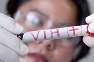 Eliminan el virus del VIH a 6 pacientes con transplante de células madre