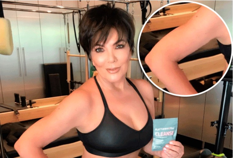 Kylie Jenner se corta el pelo para exclusiva campaña