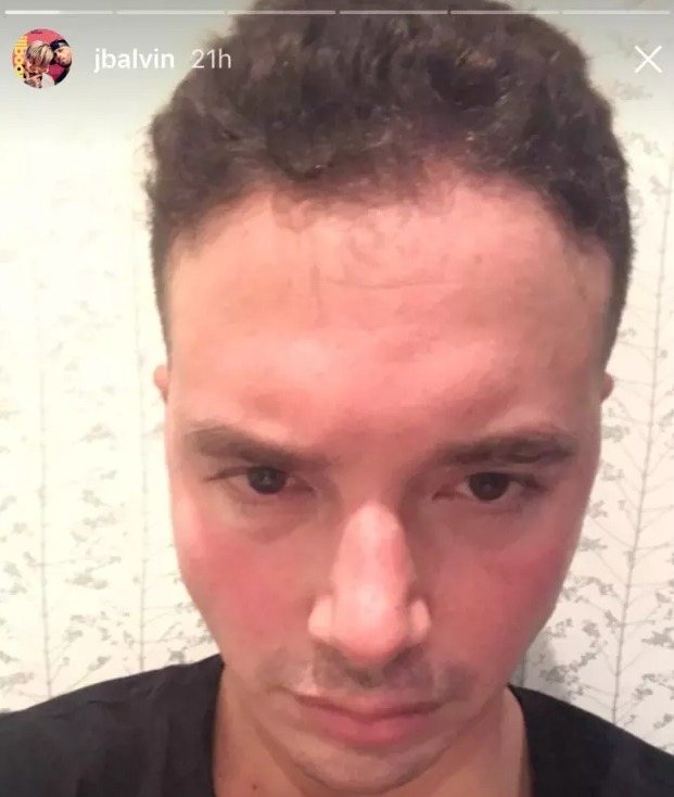 jbalvin