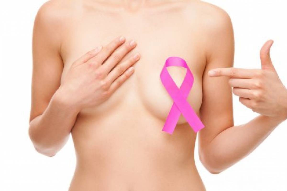 cáncer de mama