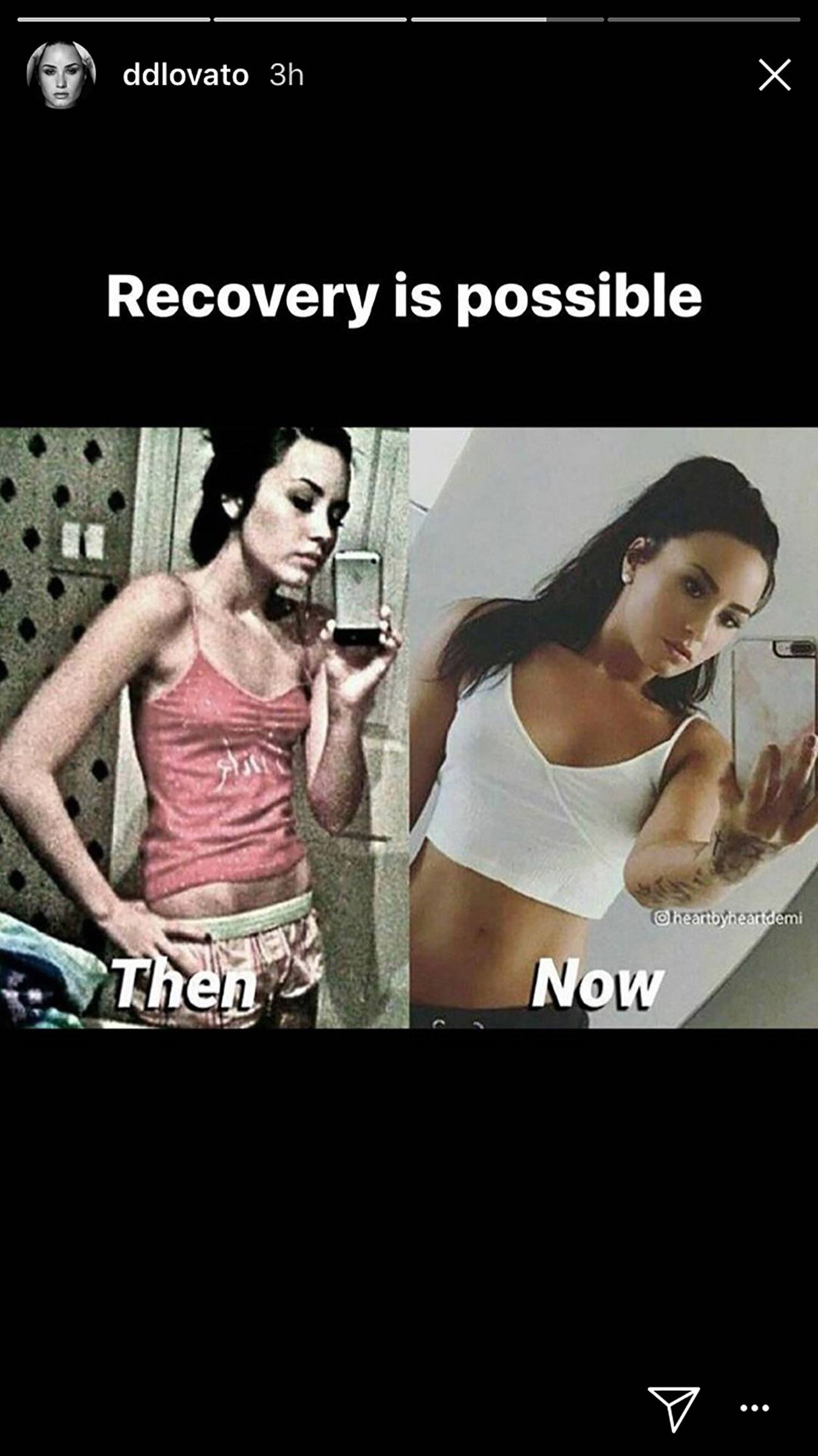 Demi Lovato