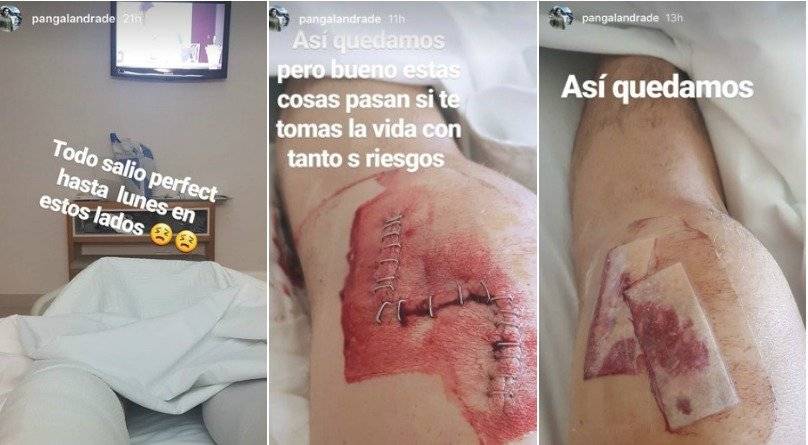 herida