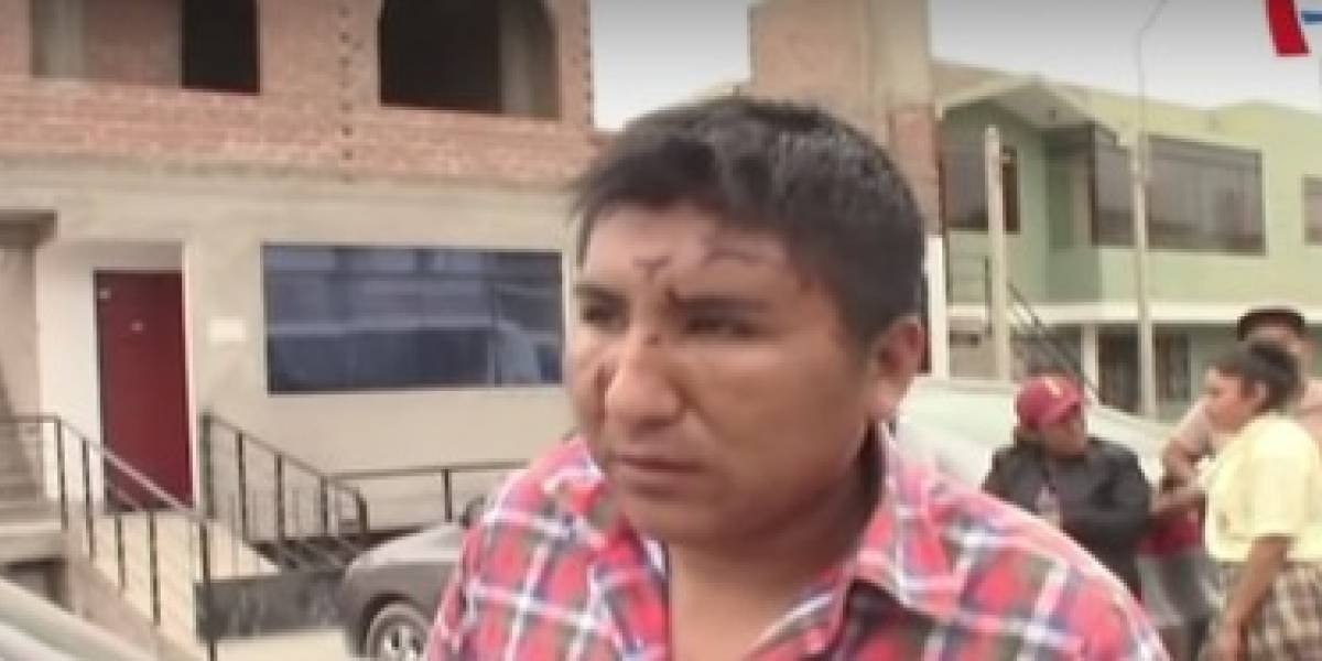 Taxista quedó desfigurado tras defender a joven de ser violada — Perú