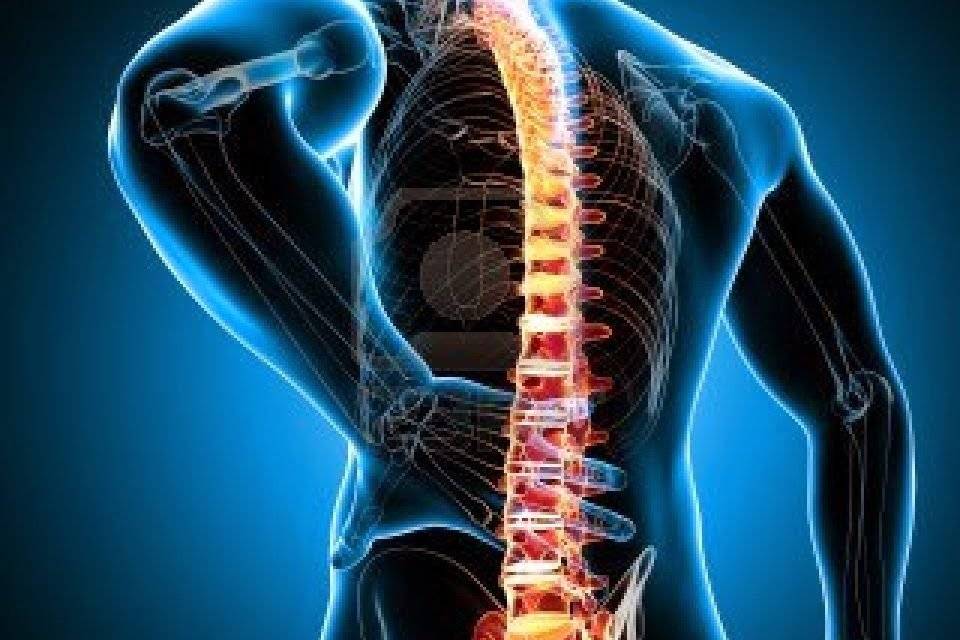 espondilitis