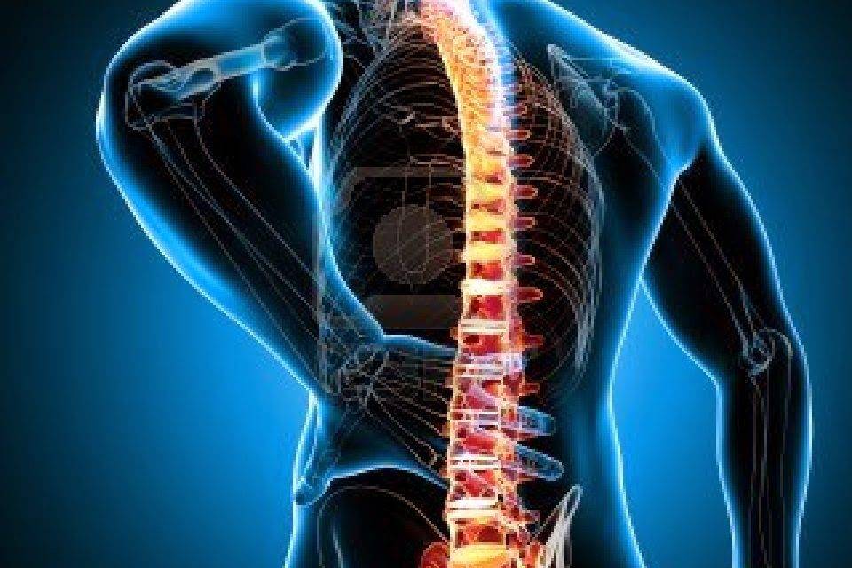 espondilitis