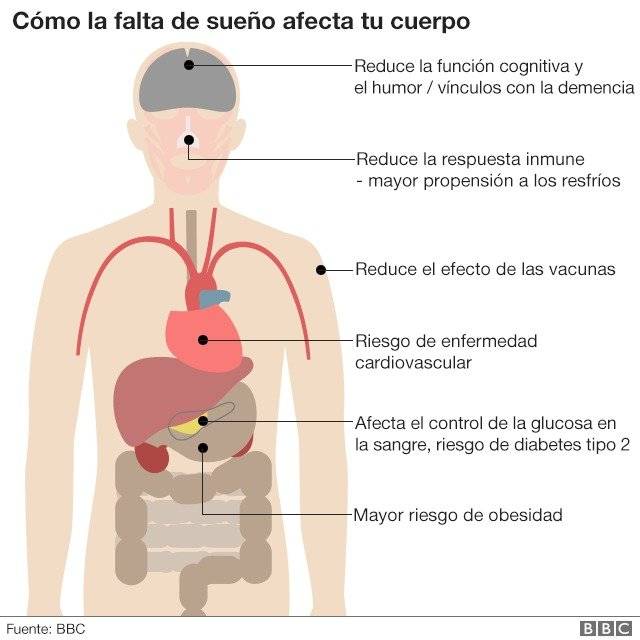 98544972sleepinchartsbodyv2spanish640nc2-b21ab47c5707b15931f3475a9e7d03fc.jpg