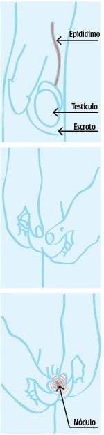 exame prostata