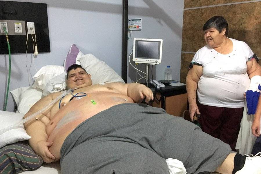 Dan de alta al hombre más obeso del mundo, se sometió a cirugía