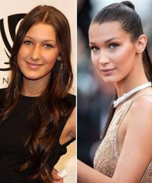 Bella Hadid antes y después
