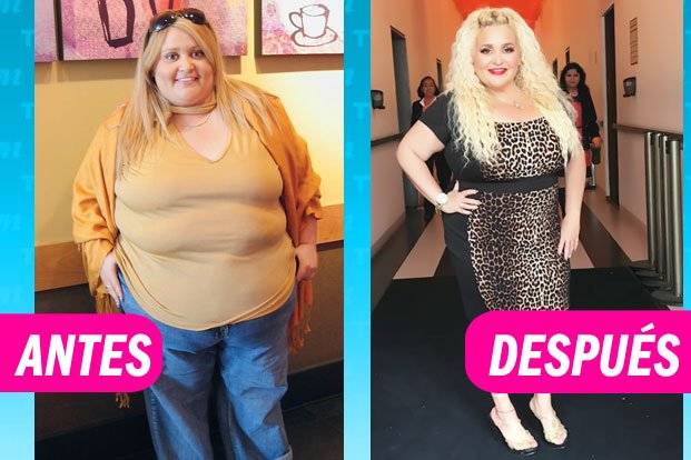 Sheyla antes y después