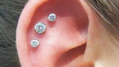 arete