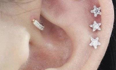 arete2