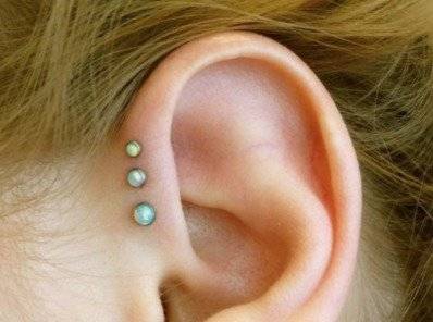 arete3
