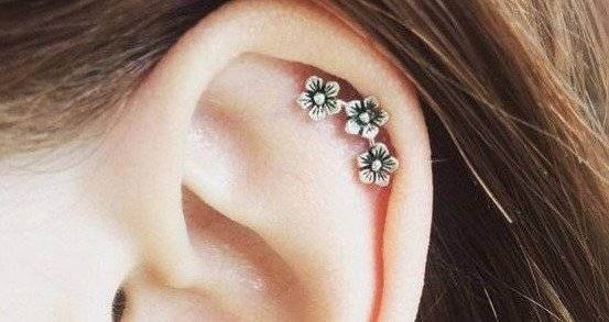 arete4