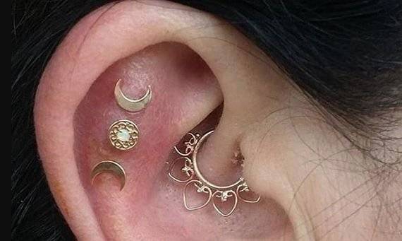 arete7