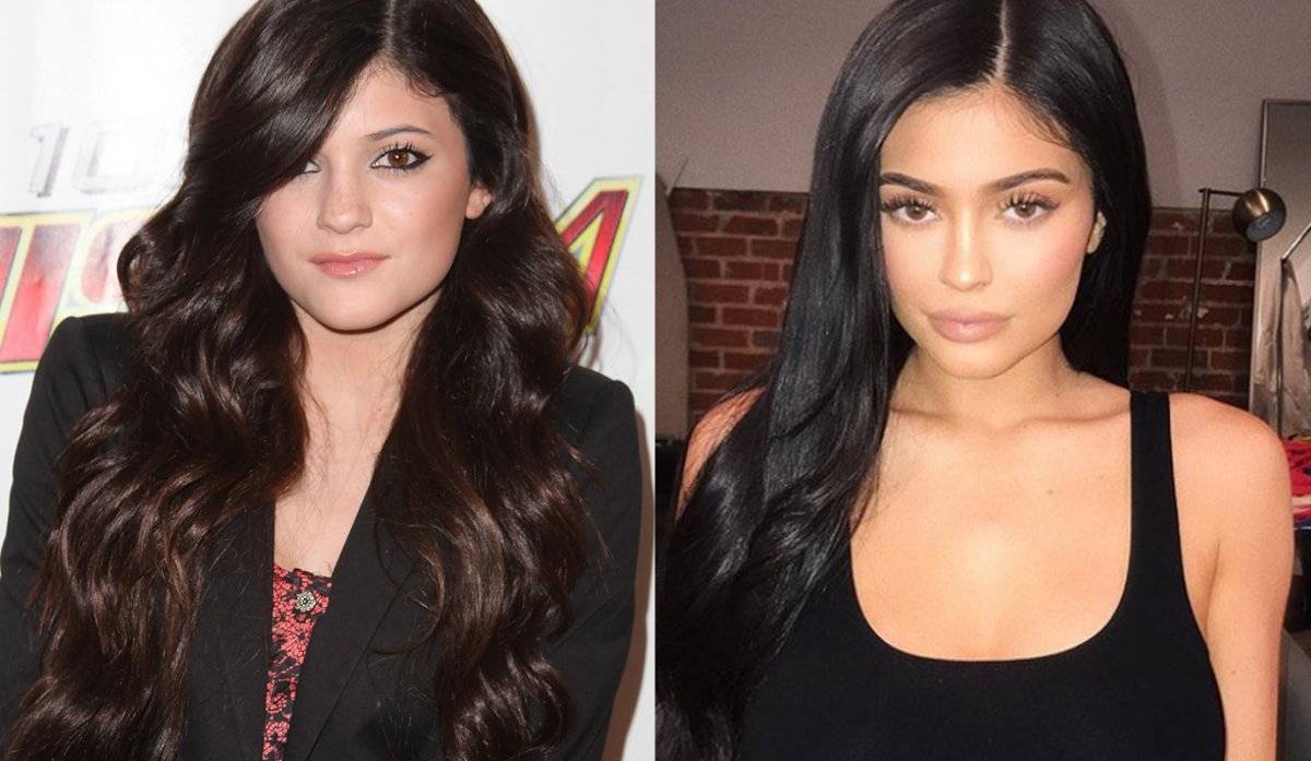 kylie