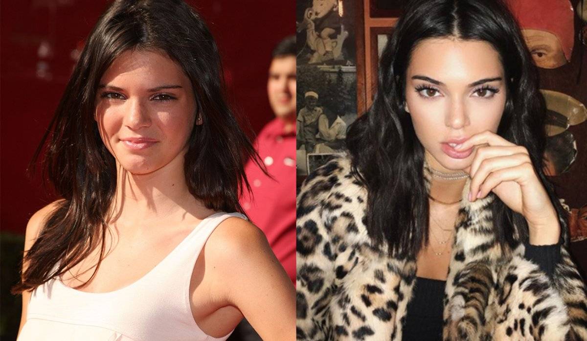 kendall jenner