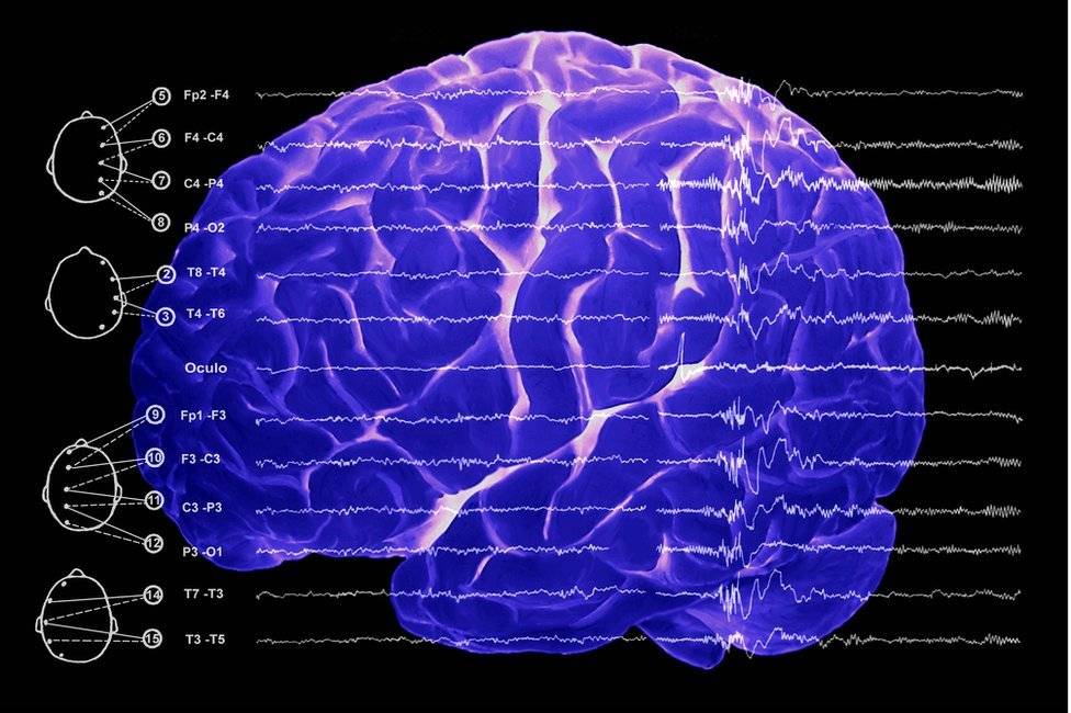 99576734b71b9d3849f94be5885b40435341c24a-977943c0781f72cbd370833a3c789d69.jpg