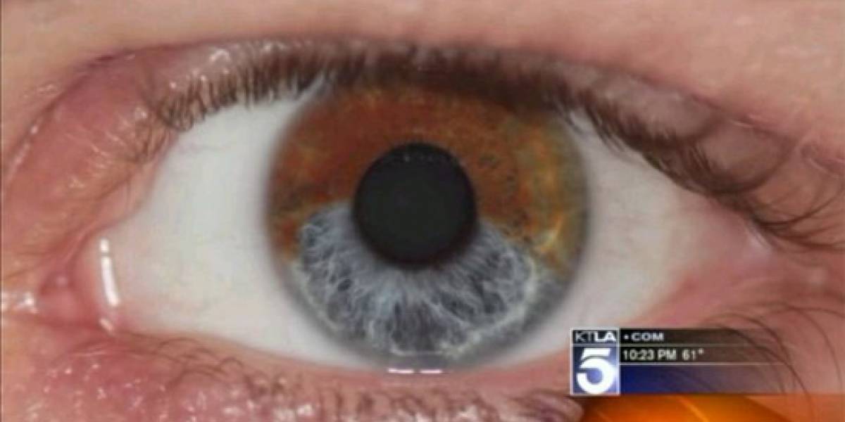 ¿Quieres tener los ojos azules?