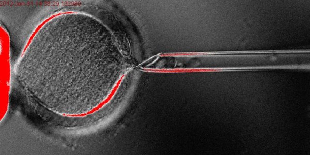 Por primera vez en la historia logran clonar células madre embrionarias humanas