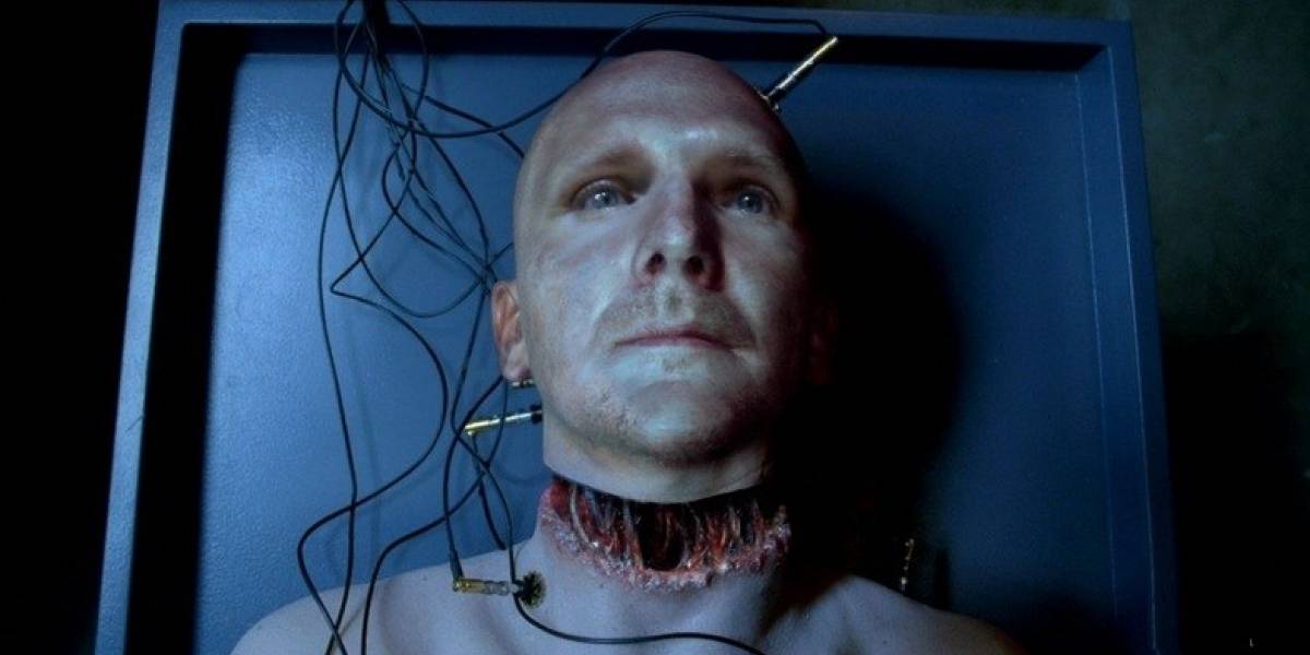 Cirujanos realizan con "éxito" el primer trasplante de cabeza en un cadáver