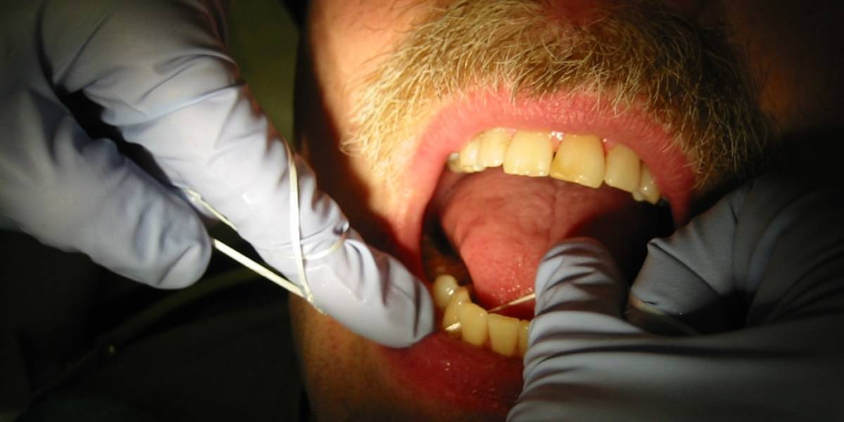¿Usas hilo dental? Descubren que sus beneficios no están comprobados