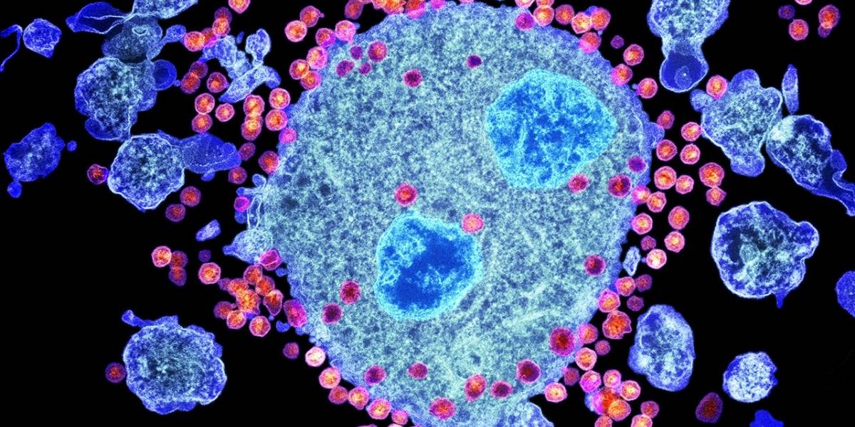 Descubren proteína que almacena VIH de manera secreta en pacientes infectados