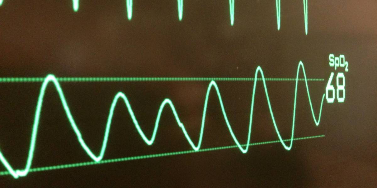 Análisis de antivirus interrumpió un procedimiento cardíaco
