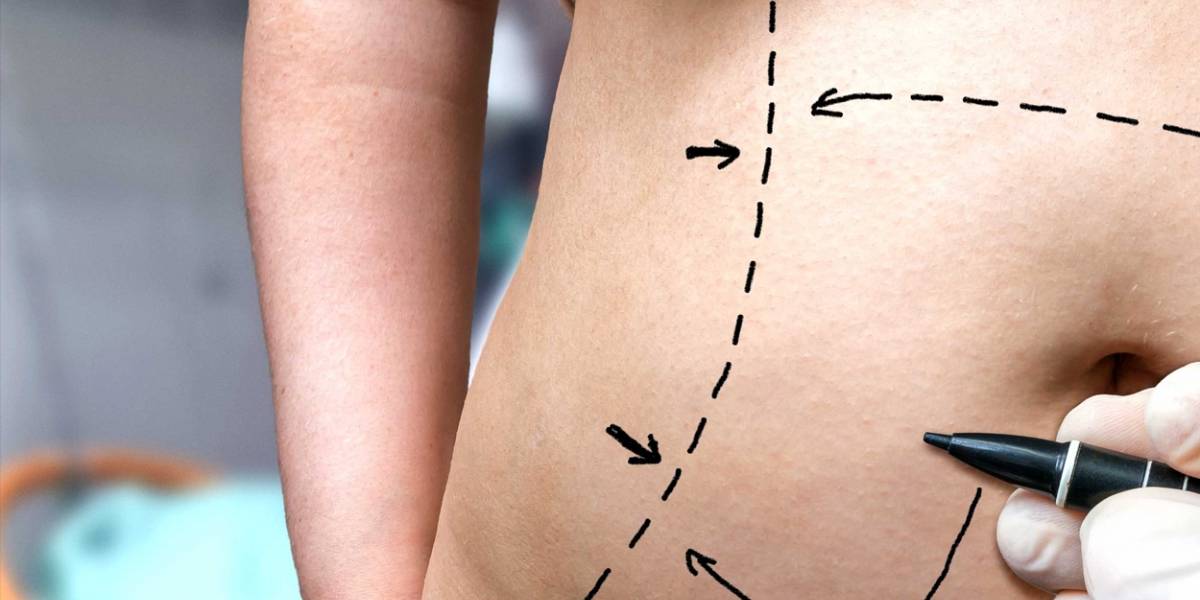 Científicos crean parche para reducir la barriga con drogas
