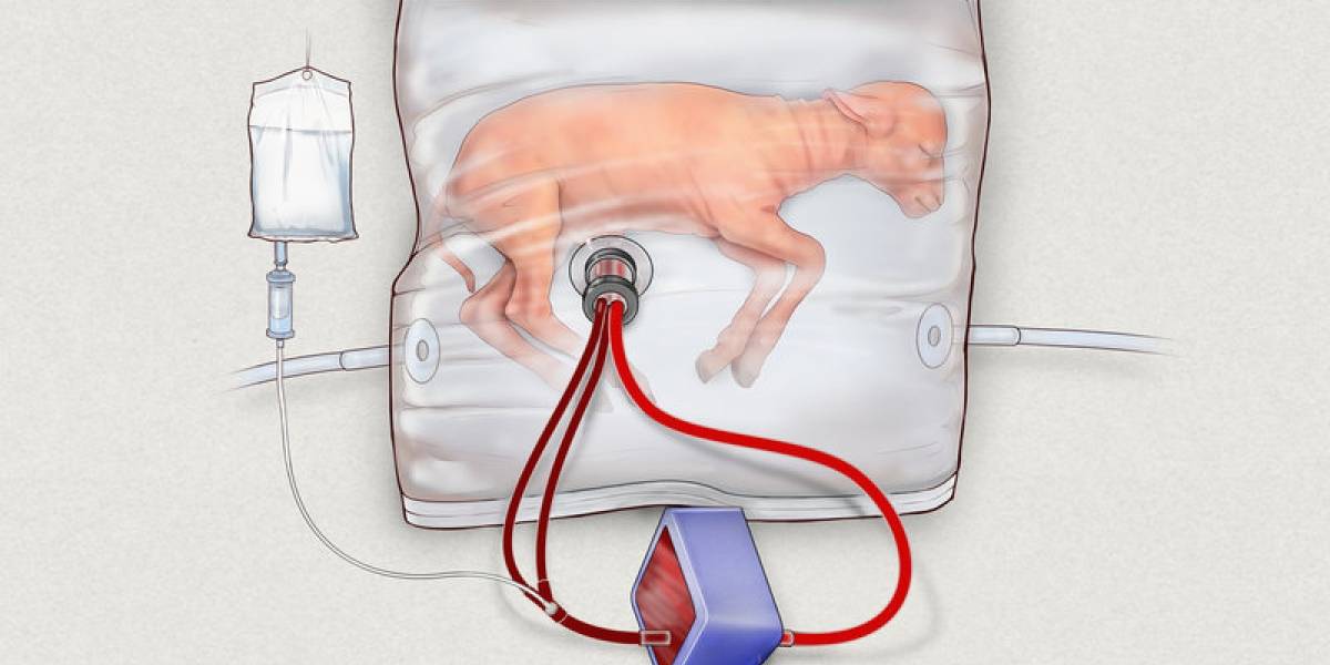 Científicos crean útero artificial para ayudar en nacimientos prematuros