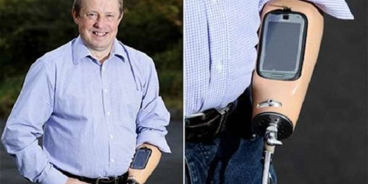 Británico aprovechó su brazo ortopédico para incrustarle su teléfono