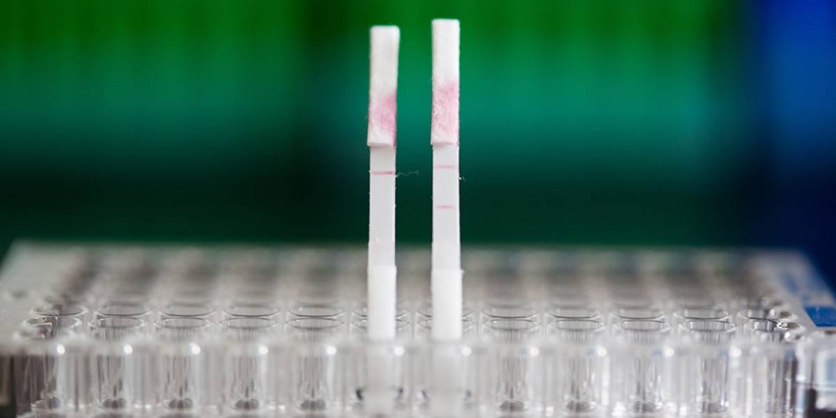 Equipo del MIT busca diagnosticar el cáncer mediante un test de orina