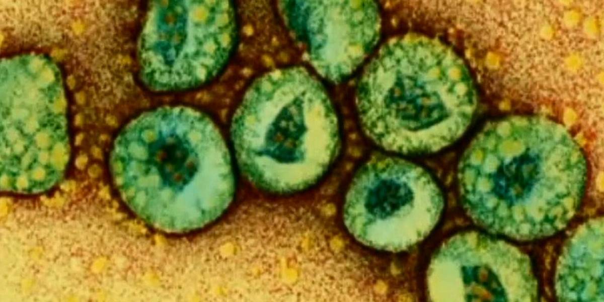 Un virus que nos hace "más estúpidos"