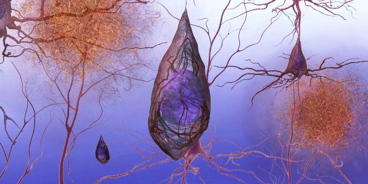 Un método no invasivo puede detectar el Alzheimer antes de que haya síntomas