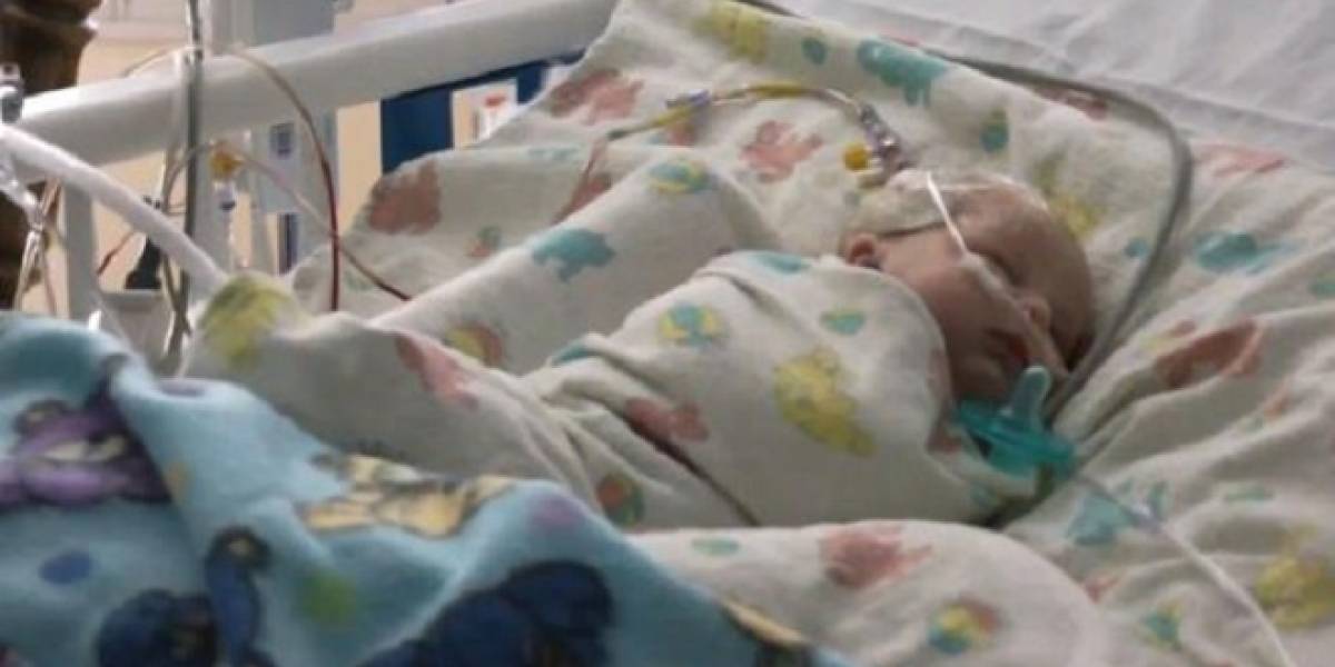 Cirujanos cierran aneurisma en cerebro de un bebé utilizando super pegamento