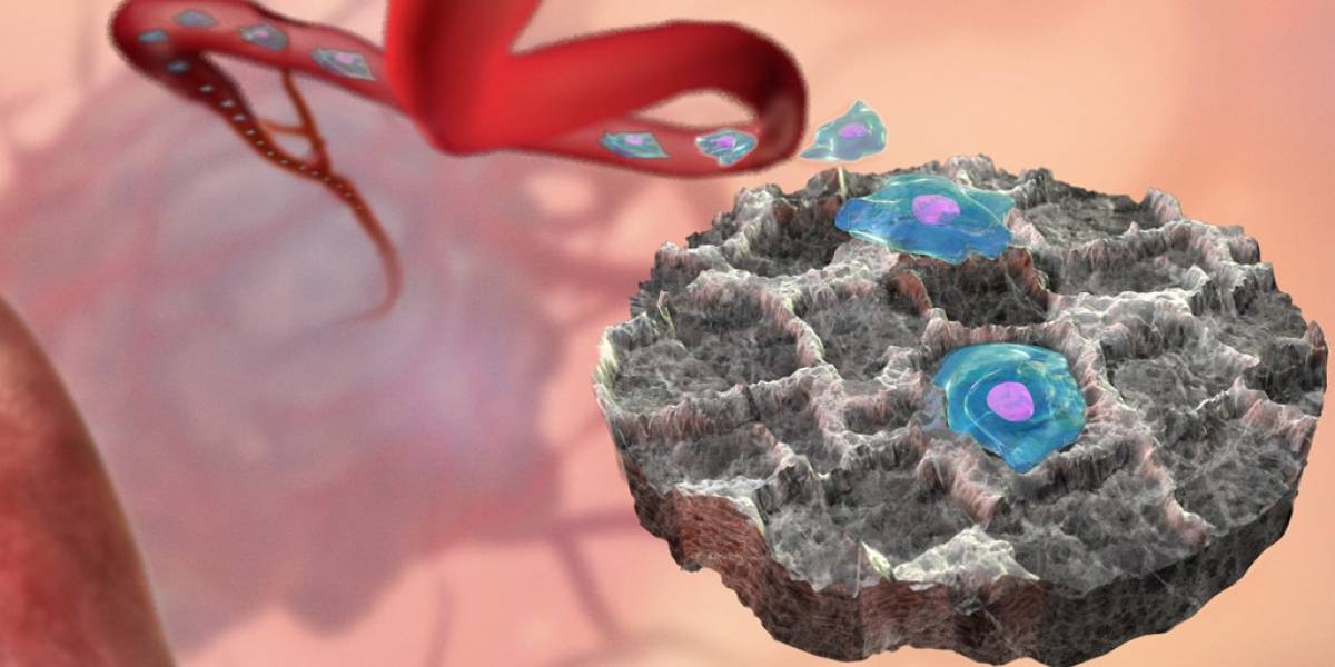 Señuelo implantable puede atraer y capturar células cancerígenas