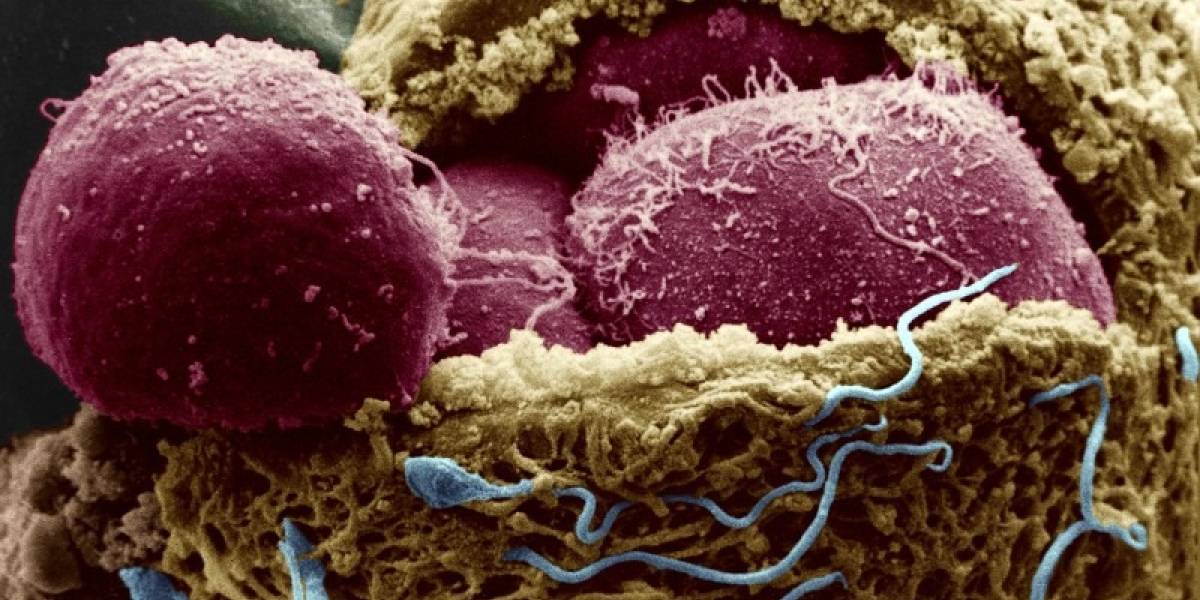 FDA comenzó a debatir sobre la técnica para crear bebés a partir de tres personas