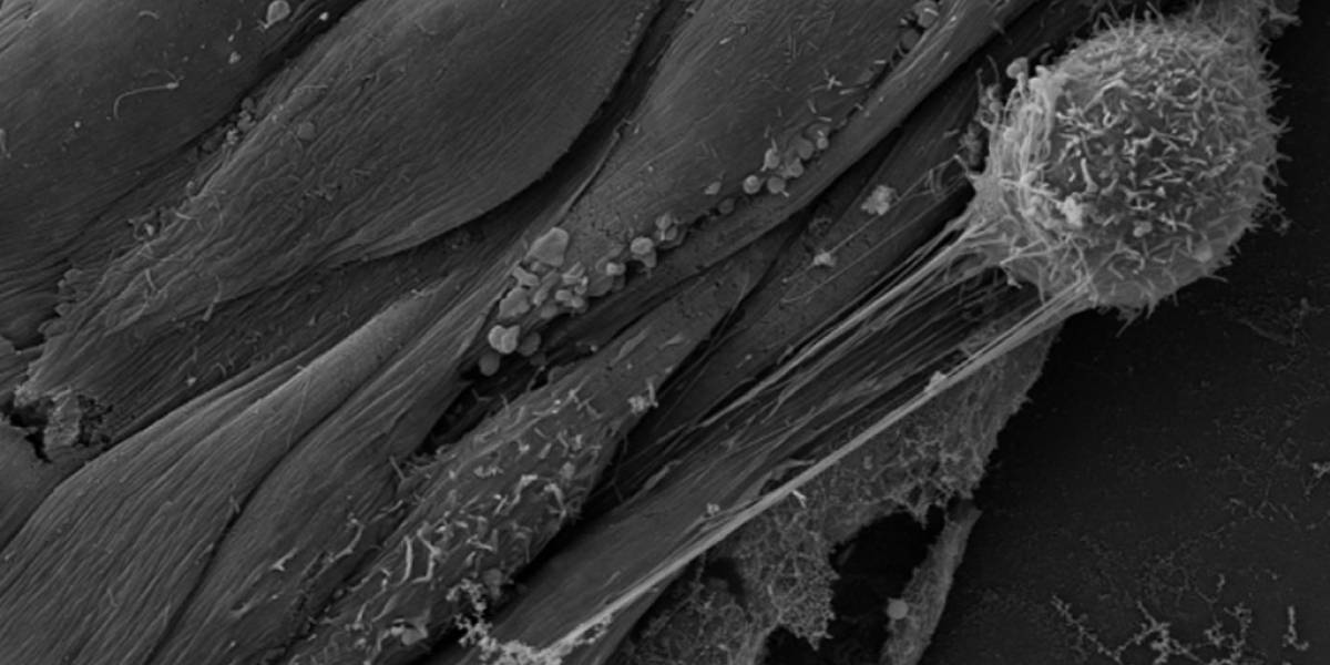Científicos descubren cómo el cáncer escapa de los vasos sanguíneos