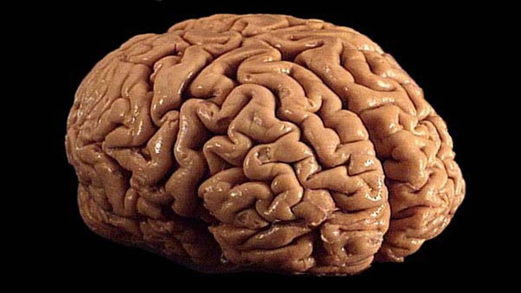 Científicos lograron reactivar cerebros de cerdos 4 horas después de muertos Científicos lograron reactivar cerebros de cerdos 4 horas después de muertos