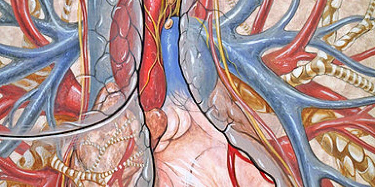 Instalan el primer 'corazón artificial' permanente en España