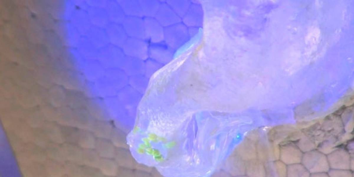 Científicos trabajan en sensor implantable de azúcar en la sangre