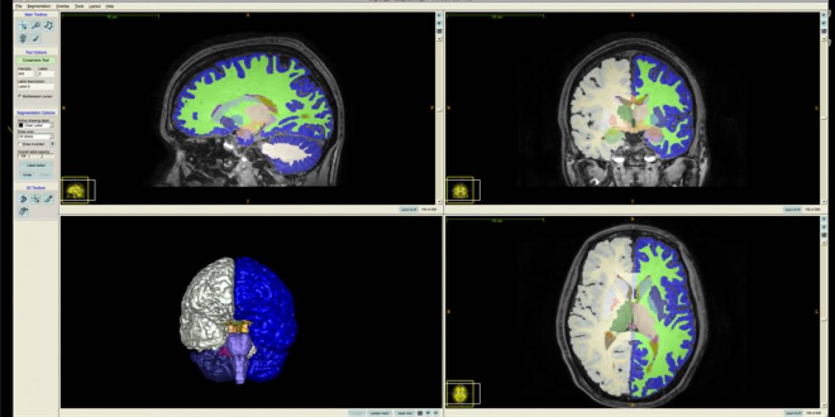 WTF? Los escáner cerebrales salen diferente según se visualicen en Linux o Mac OS X