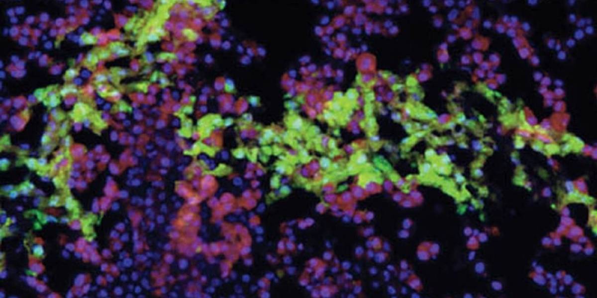 Bioingenieros logran crear pequeños hígados funcionales con impresora 3D