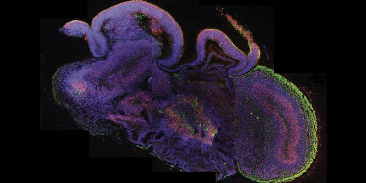 Científicos crean un mini cerebro en laboratorio por primera vez