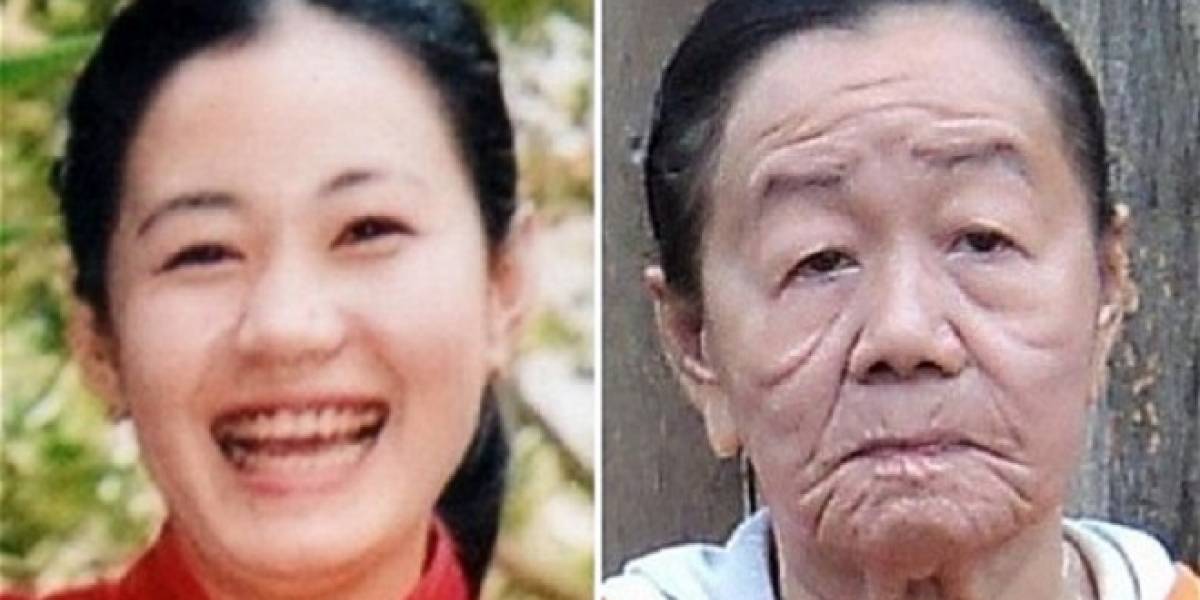 Mujer vietnamita sufre extraña enfermedad que avejentó su aspecto en 50 años