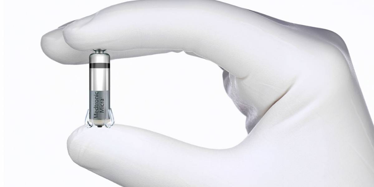 Este marcapasos de una pulgada puede ser implantado sin cirugía