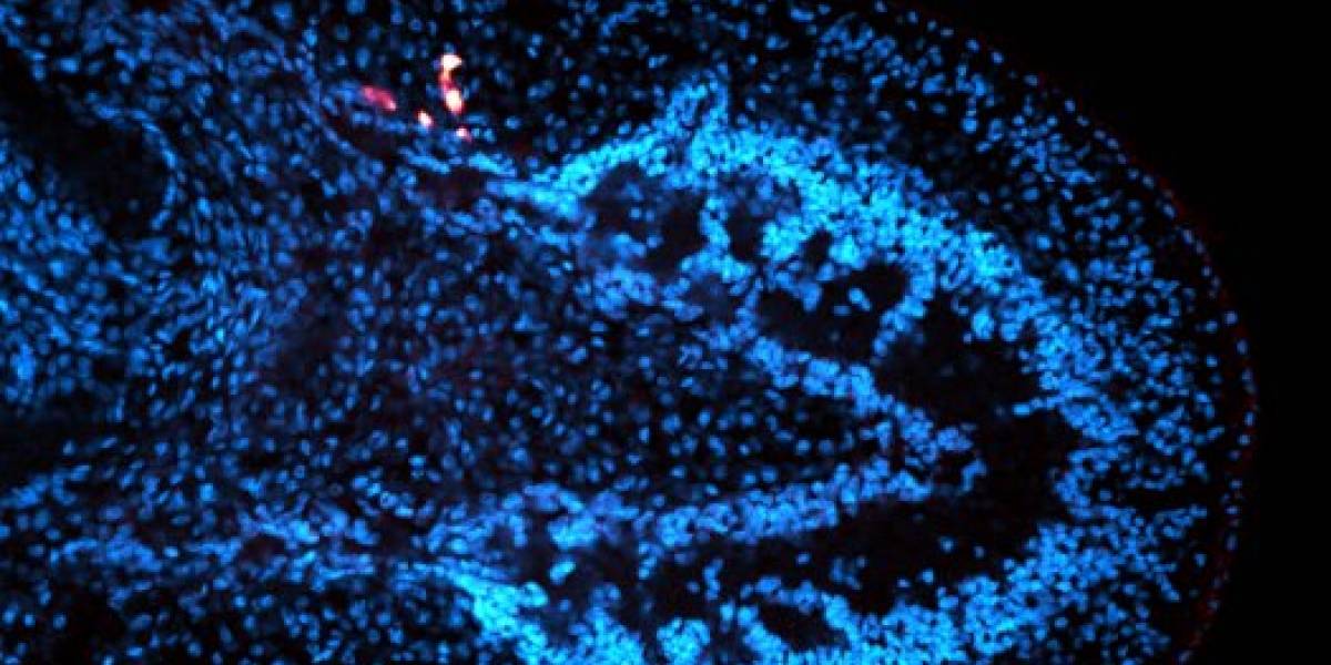 Gusano regenera un cuerpo completamente nuevo a partir de sólo una célula