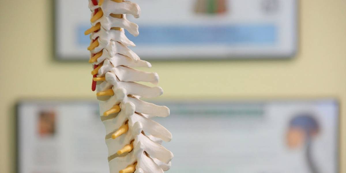 Implantan la primera vértebra impresa en 3D a un niño de 12 años