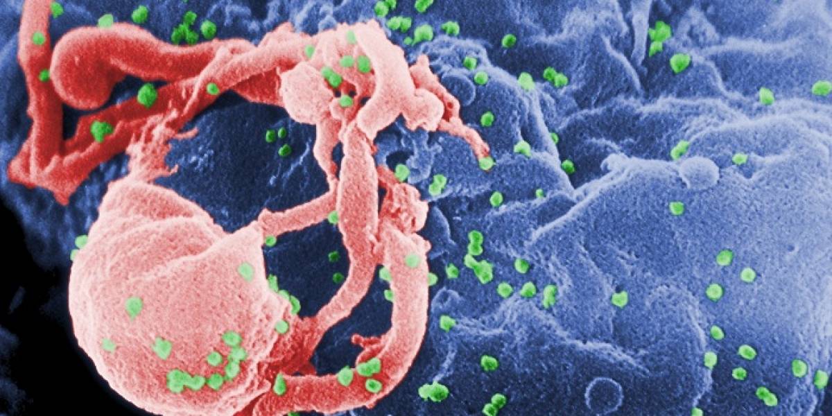Científicos desarrollan técnica que desactiva el VIH en el organismo